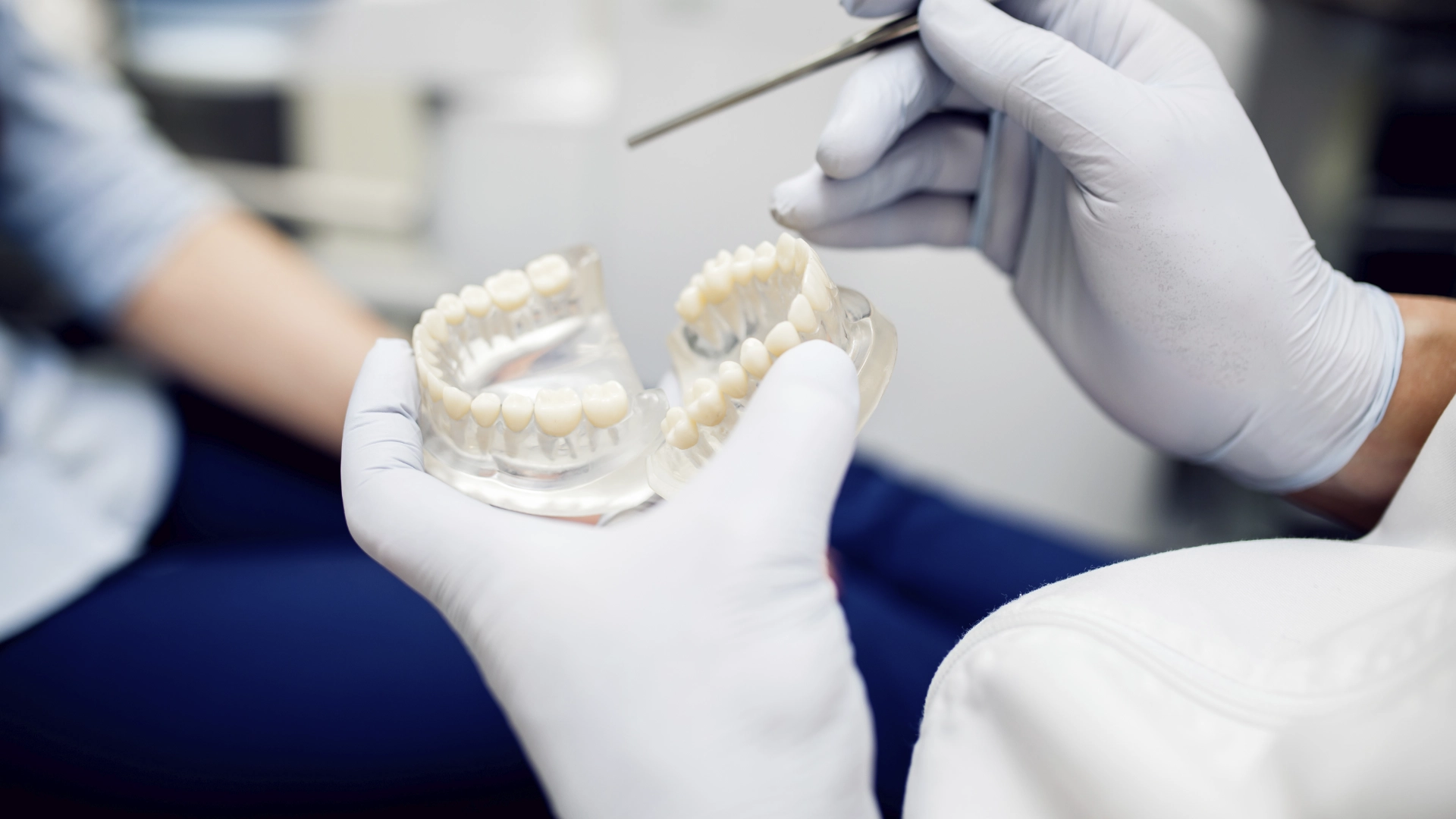 Implante dental de carga inmediata