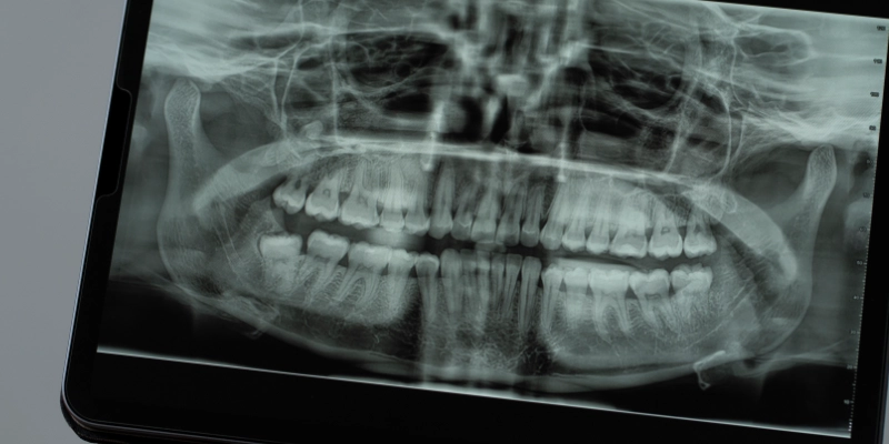Tac dental